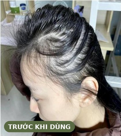 Trước khi dùng