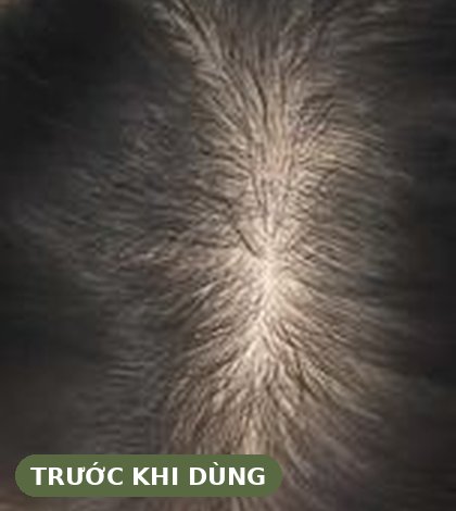 Trước khi dùng