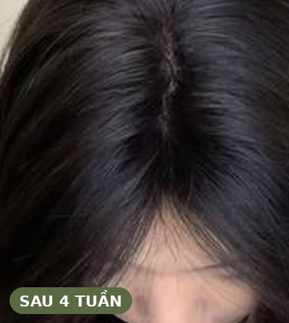 Sau 4 tuần