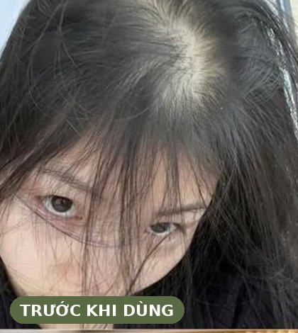 Trước khi dùng