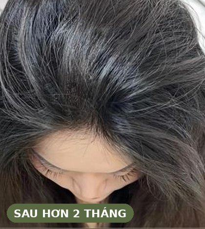 Sau hơn 2 tháng